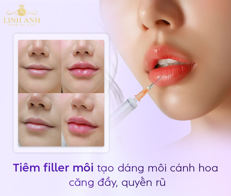 như thế nào là môi cánh hoa như thế nào là môi cánh hoa