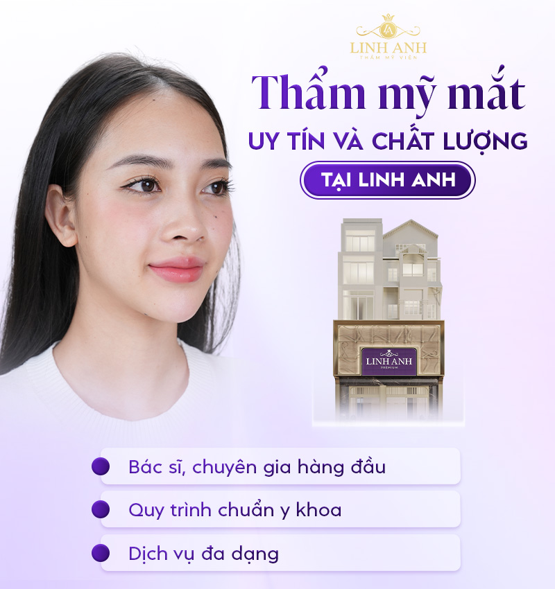 nữ giới sở hữu mắt lá khoai nữ giới sở hữu mắt lá khoai
