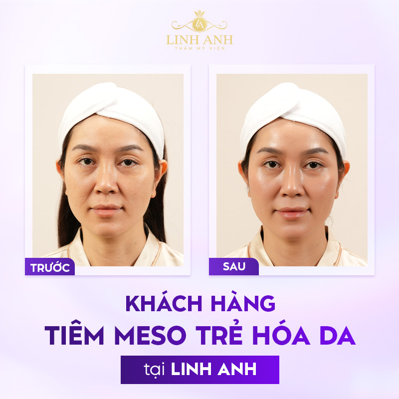 review địa chỉ tiêm meso uy tín review địa chỉ tiêm meso uy tín