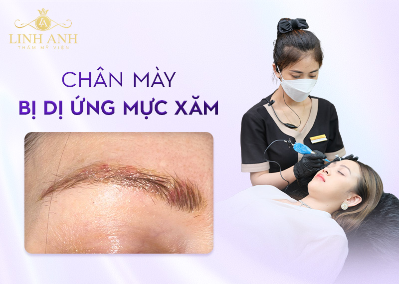 rủi ro khi xăm chân mày rủi ro khi xăm chân mày