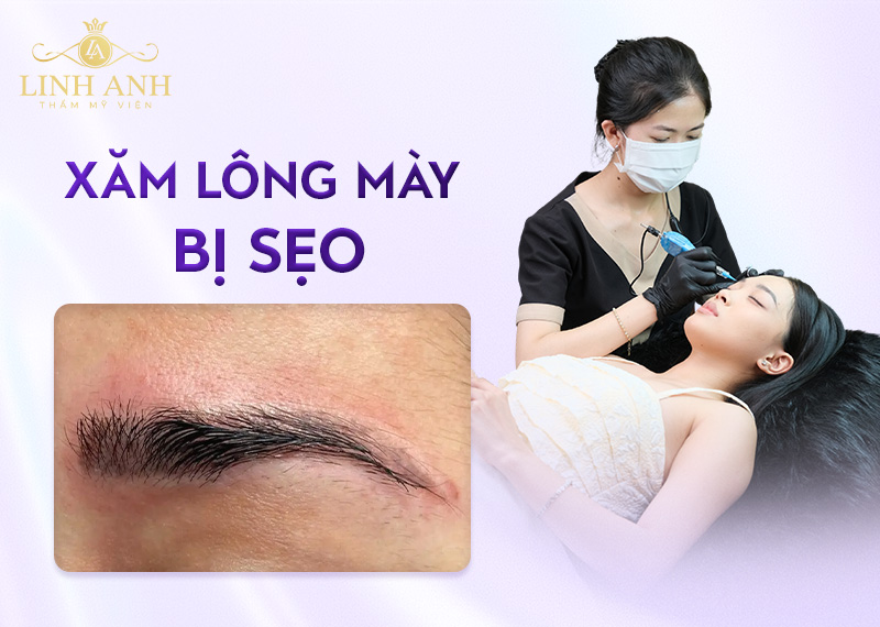 rủi ro liên quan đến xăm chân mày rủi ro liên quan đến xăm chân mày