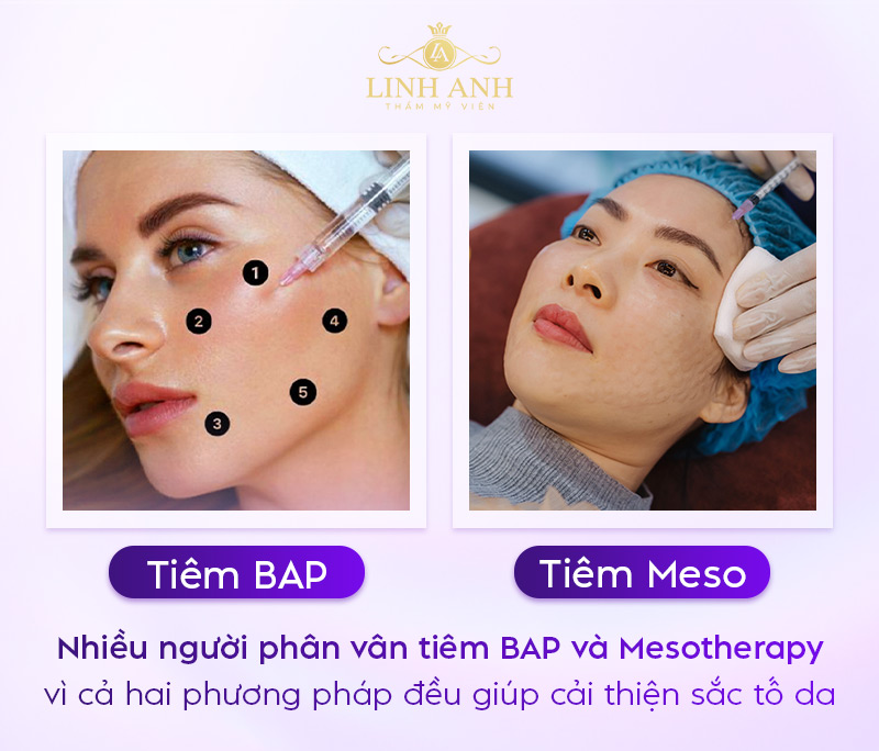 So sánh tiêm meso và BAP So sánh tiêm meso và BAP