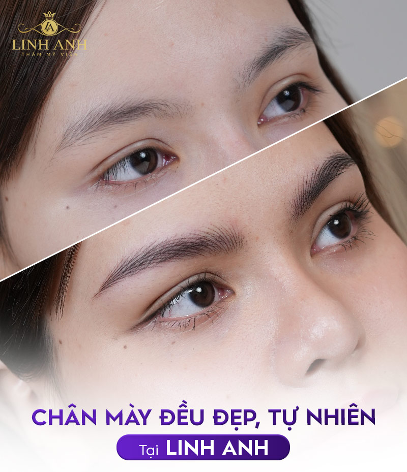 tác hại của phun xăm chân mày tác hại của phun xăm chân mày