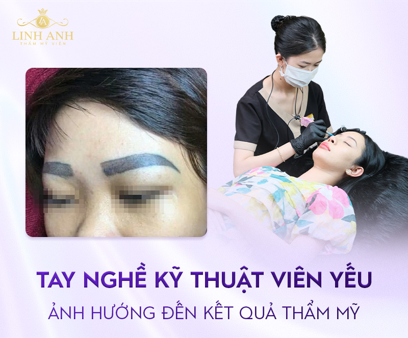 tác hại của xăm chân mày là gì tác hại của xăm chân mày là gì