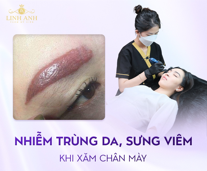 tác hại khi xăm chân mày tác hại khi xăm chân mày