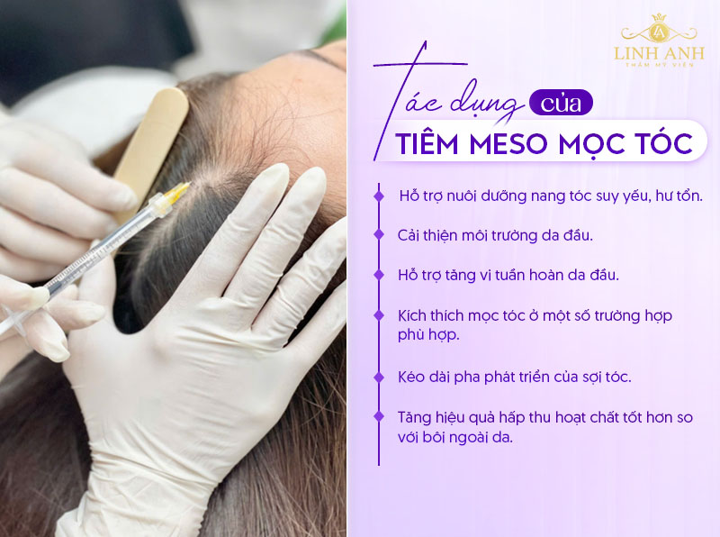 Tiêm kích mọc tóc Tiêm kích mọc tóc