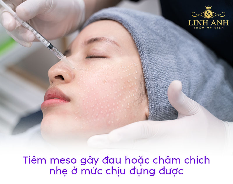 Tiêm meso có đau hay không