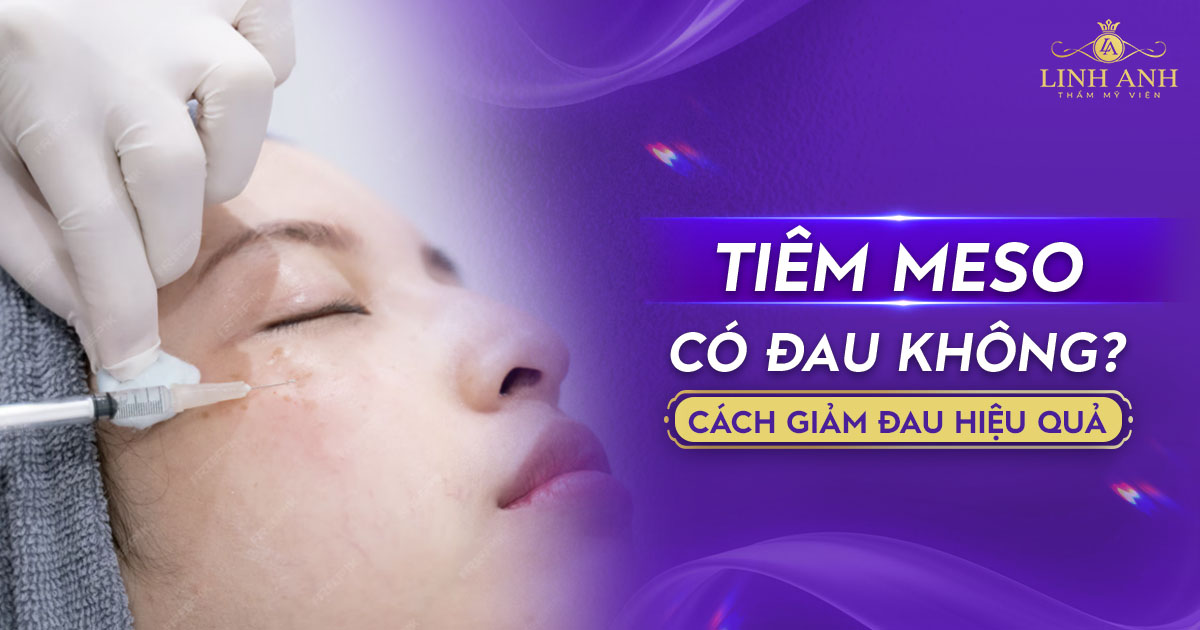 So sánh mức độ đau giữa Meso truyền thống và meso không kim