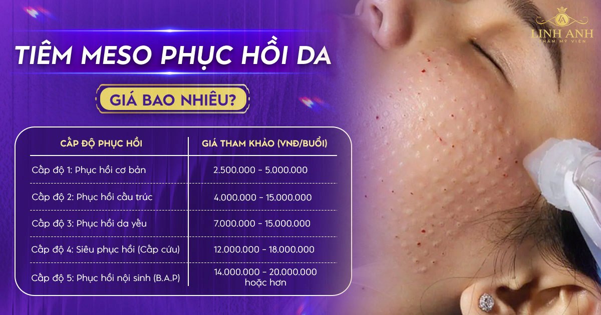 Tiêm meso phục hồi da giá bao nhiêu? Bảng giá cập nhật mới nhất