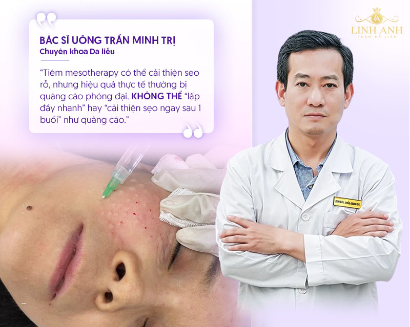 Tiêm meso trị sẹo rỗ có hiệu quả không