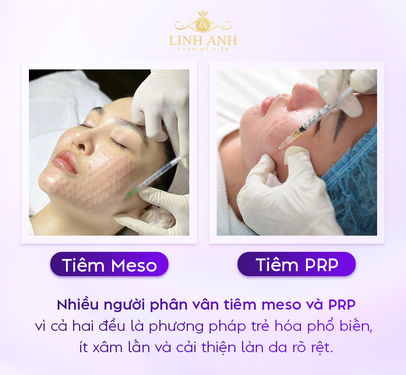 tiêm meso và PRP tiêm meso và PRP