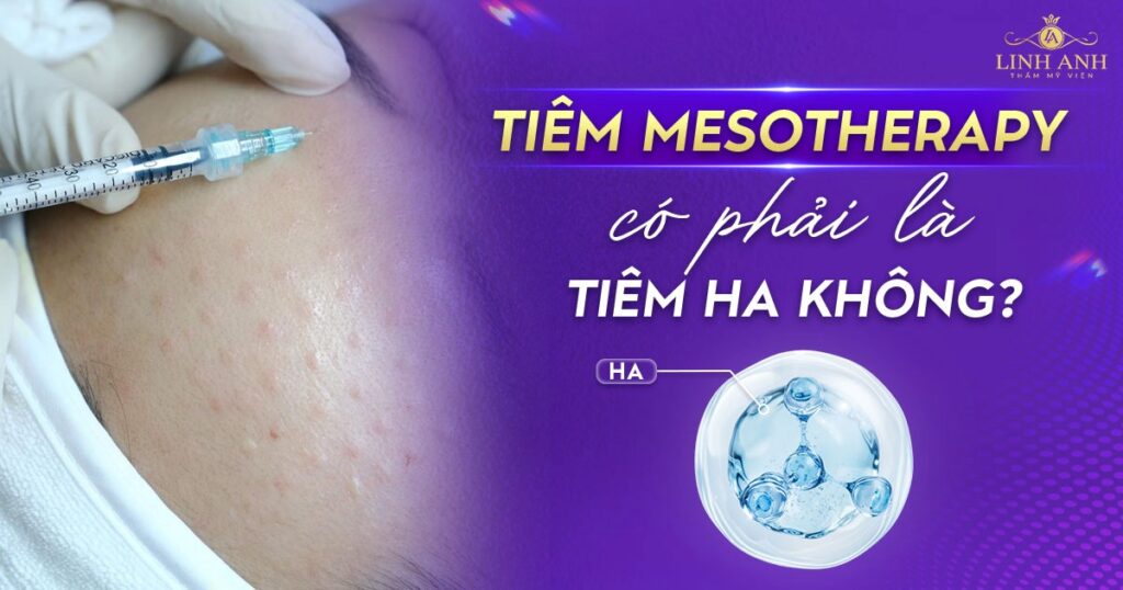 Tiêm Mesotherapy hay tiêm HA