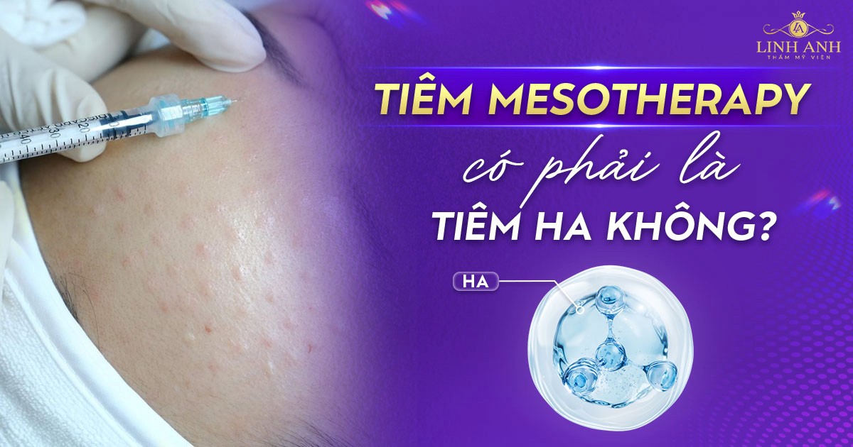 Nên chọn tiêm Mesotherapy hay tiêm HA để căng bóng da?