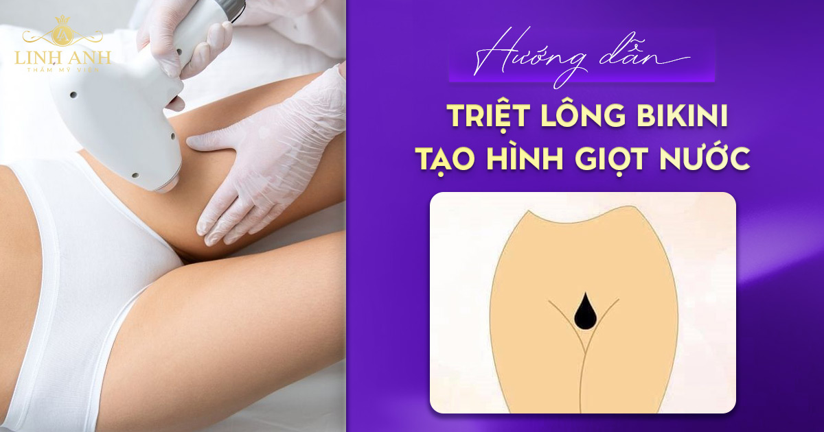 Hướng dẫn triệt lông bikini tạo hình giọt nước đẹp, quyến rũ