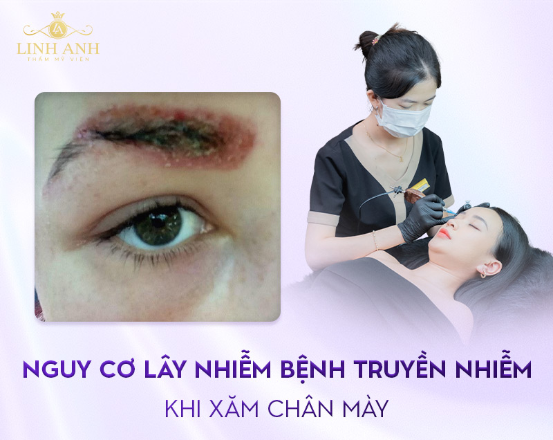 xăm chân mày có nguy hiểm không xăm chân mày có nguy hiểm không