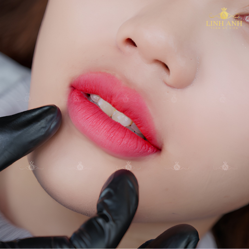 Xăm môi ăn lạc đúng cách để lên màu đẹp