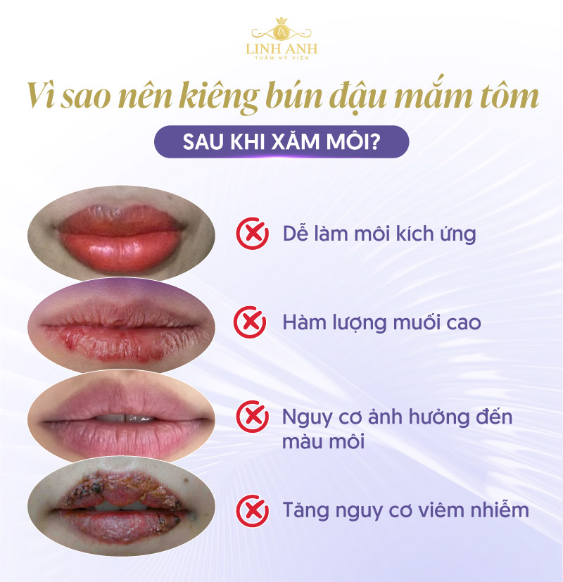Không nên ăn bún đậu mắm tôm sau phun môi