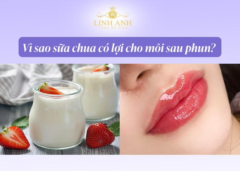 Nên ăn sữa chua sau phun môi
