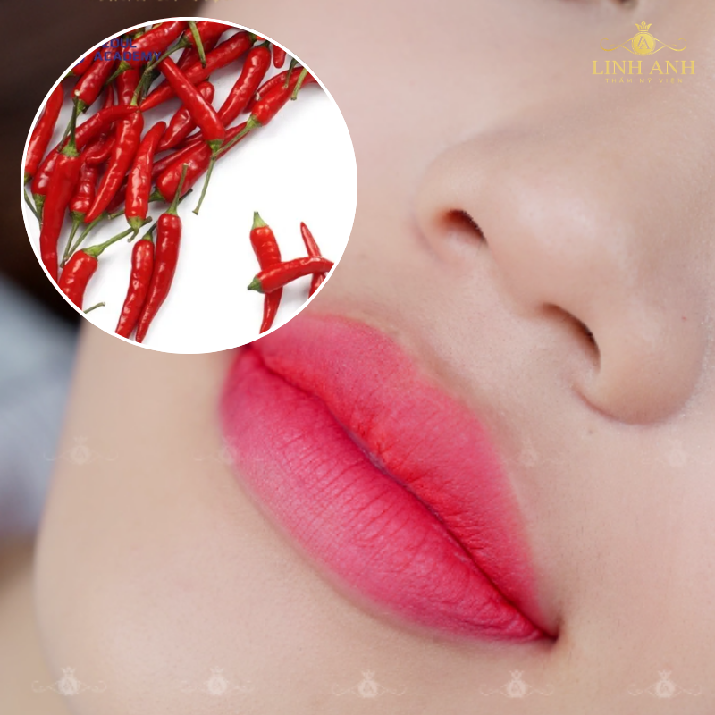 Nên kiêng ăn cay để đảm bảo an toàn cho môi sau phun