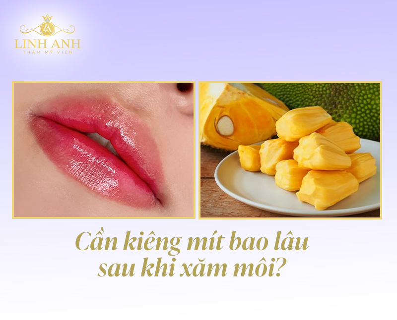 Nên kiêng mít để đảm bảo thẩm mỹ môi sau phun