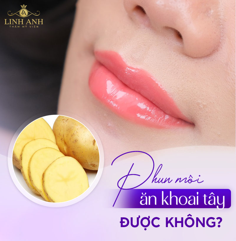 Phun môi ăn khoai tây được không
