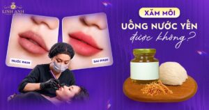 Phun môi ăn uống yến sào được không