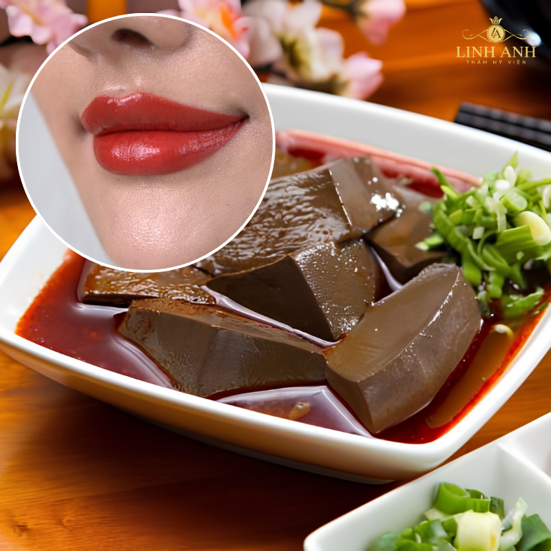 Không ăn huyết tái sau phun môi