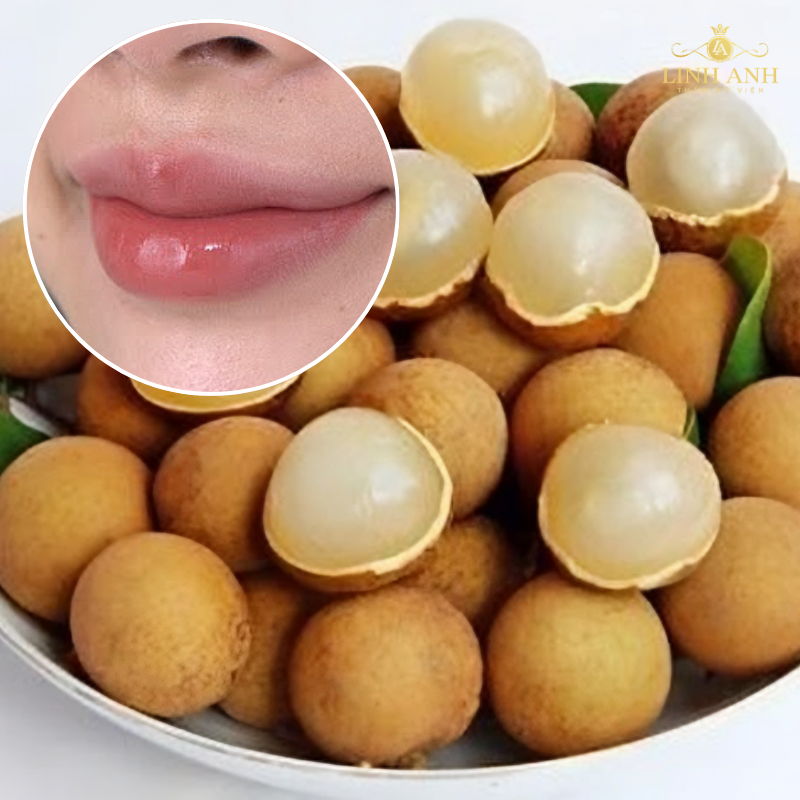 Kiêng ăn nhãn sau phun môi