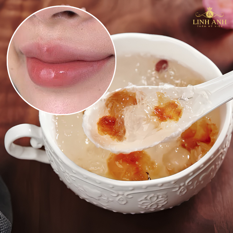 Phun môi ăn yến sào được không
