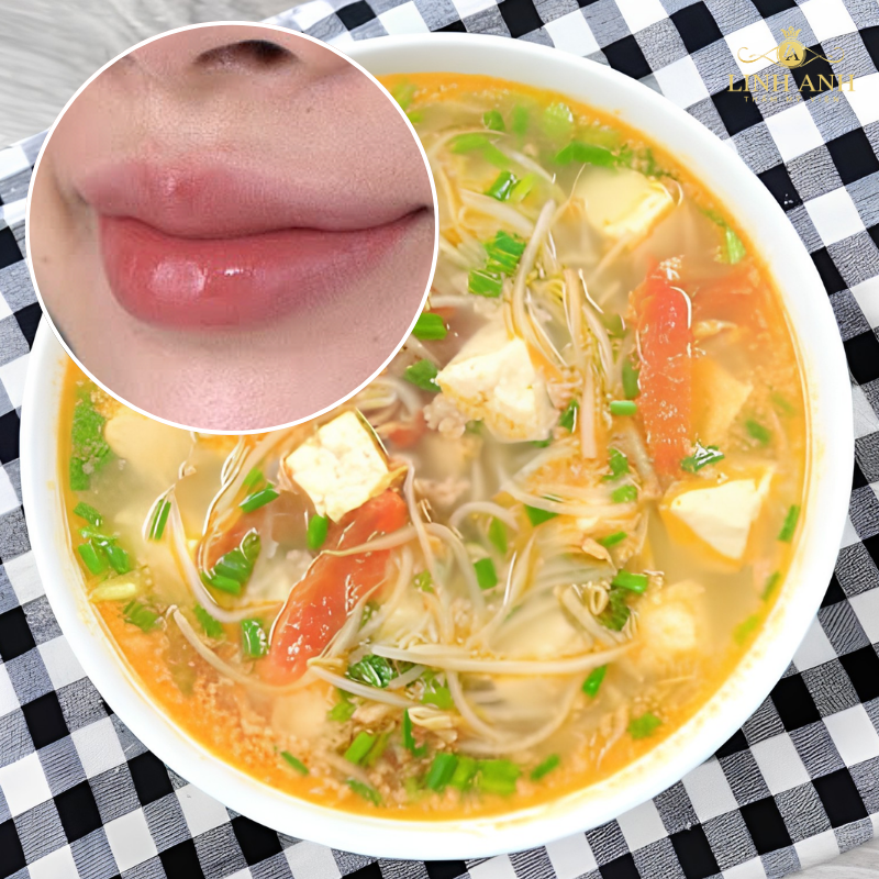 Ăn canh giá đỗ sau phun môi