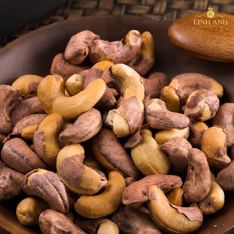Ăn hạt điều sau phun môi