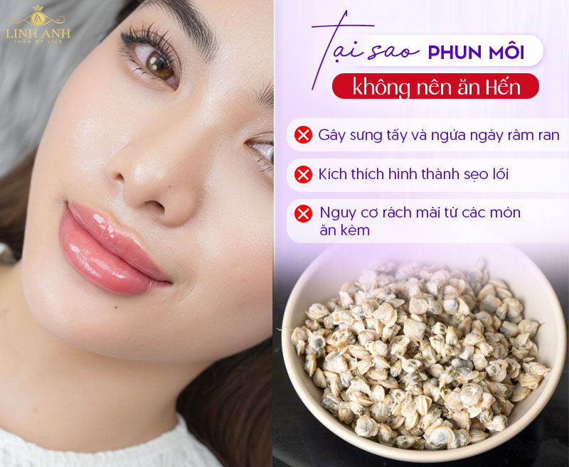 Không nên ăn hến sau phun môi