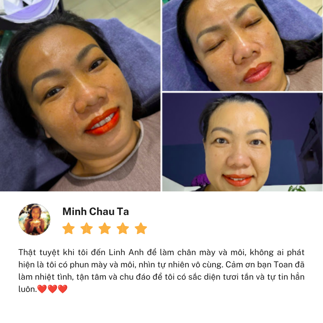 Review cơ sở Thẩm Mỹ Linh Anh Nguyễn Văn Trỗi