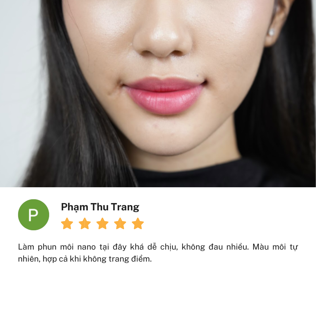 Review cơ sở Thẩm Mỹ Linh Anh Nguyễn Văn Trỗi