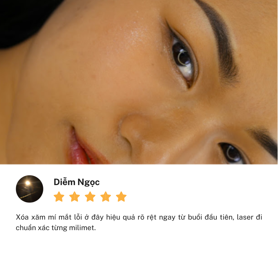 Review trải nghiệm Thẩm Mỹ Linh Anh cơ sở CMT8 Thủ Dầu Một