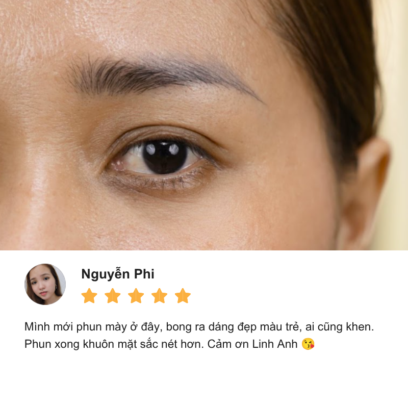 Review Thẩm Mỹ Linh Anh cơ sở Đặng Văn Bi