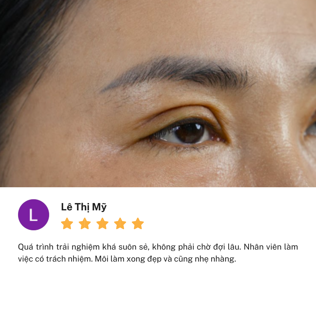 Review Thẩm Mỹ Viện Linh Anh cơ sở Đại Lộ Bình Dương