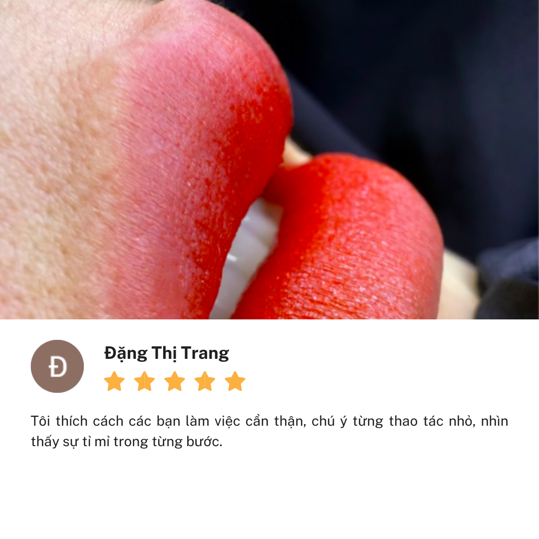 Review Thẩm Mỹ Viện Linh Anh cơ sở Đại Lộ Bình Dương