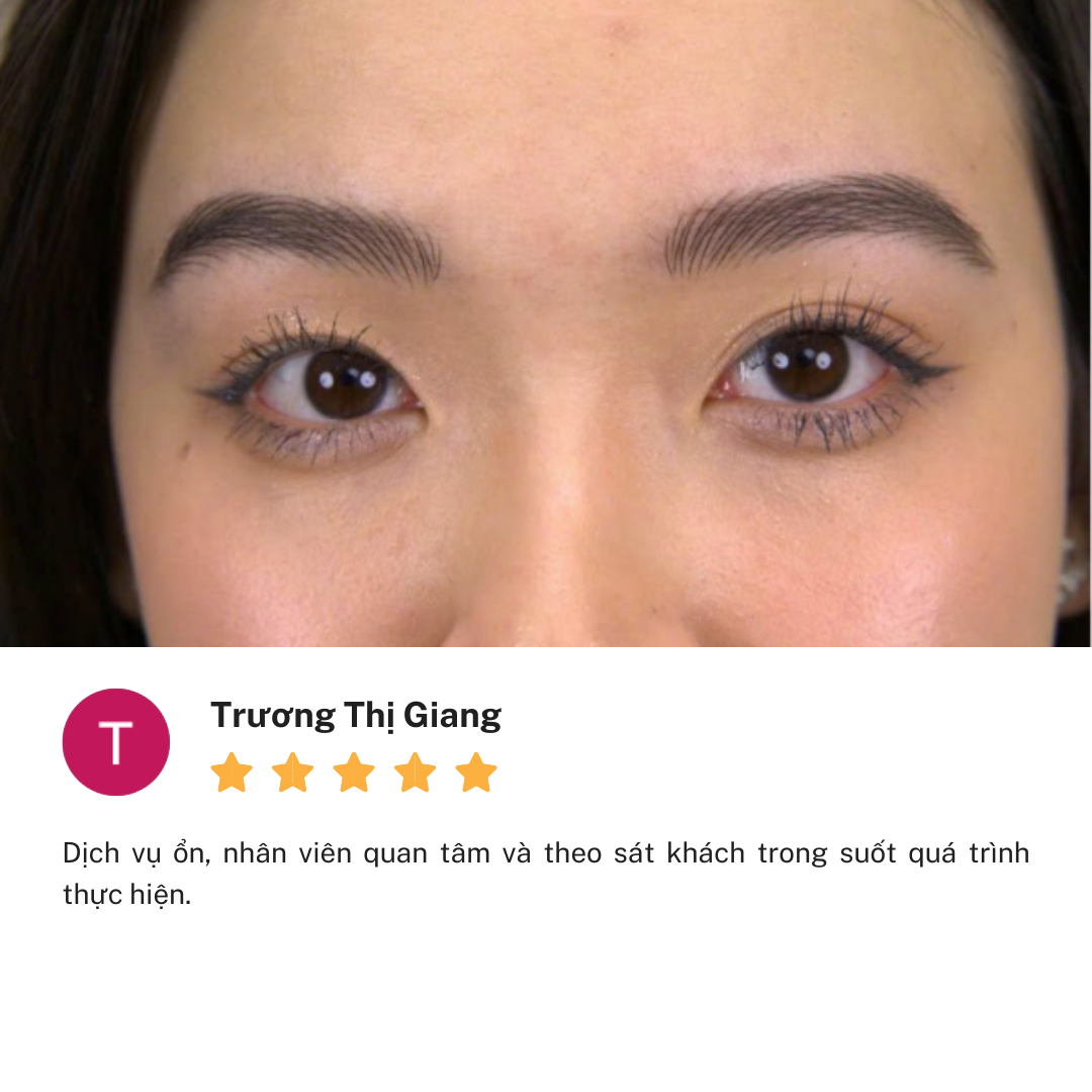 Review cơ sở Thẩm Mỹ Linh Anh Đặng Văn Bi