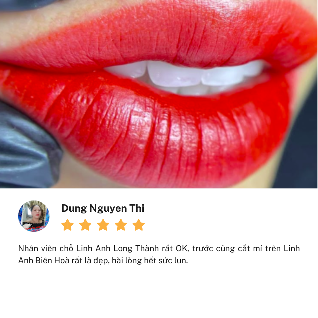 Review Thẩm Mỹ Viện Linh Anh cơ sở Lê Duẩn Đồng Nai