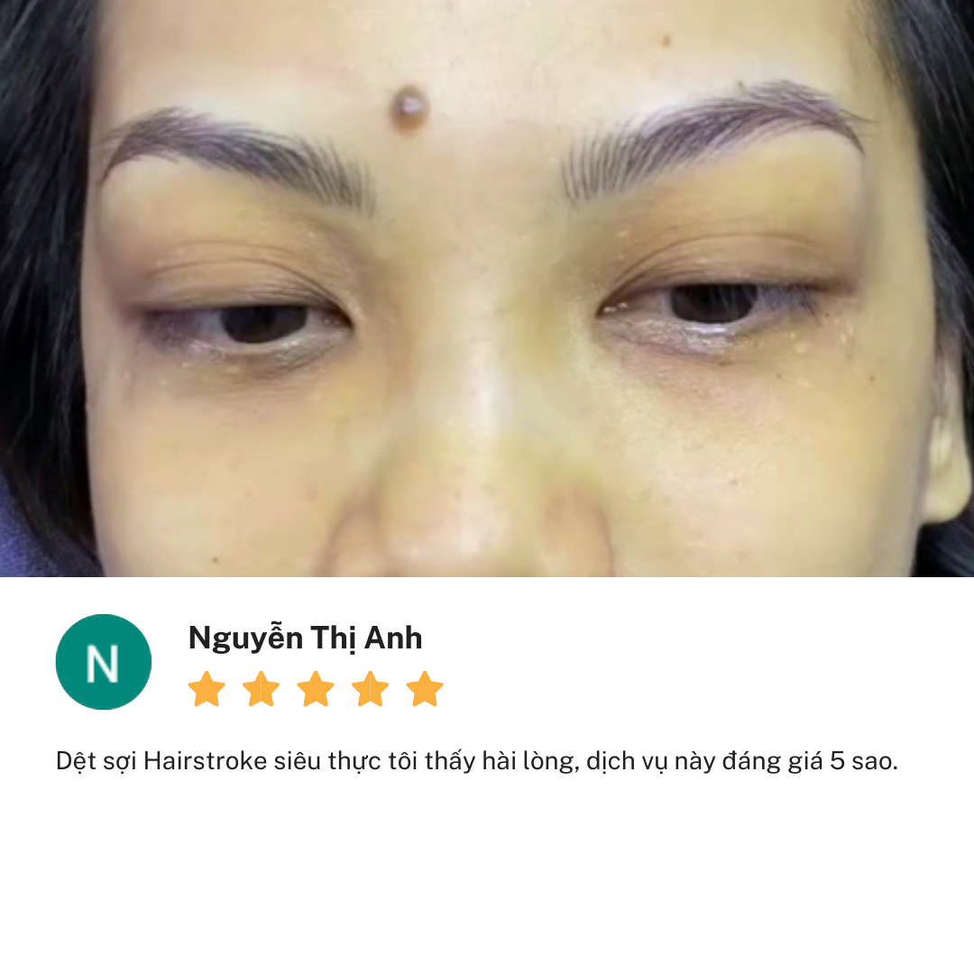Review thẩm mỹ viện Linh Anh cơ sở Nguyễn Thị Thập