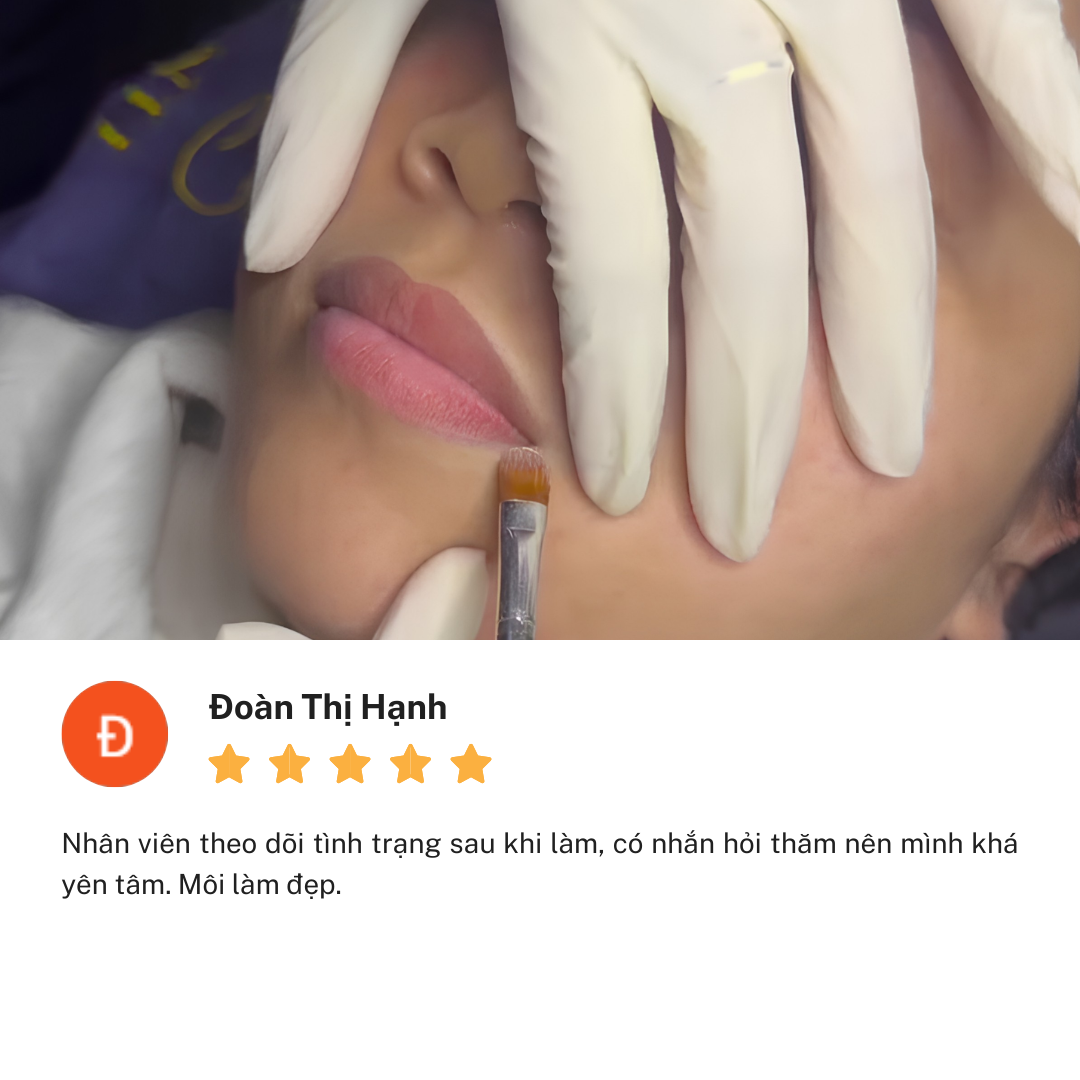 Review thẩm mỹ viện Linh Anh cơ sở Nguyễn Thị Thập