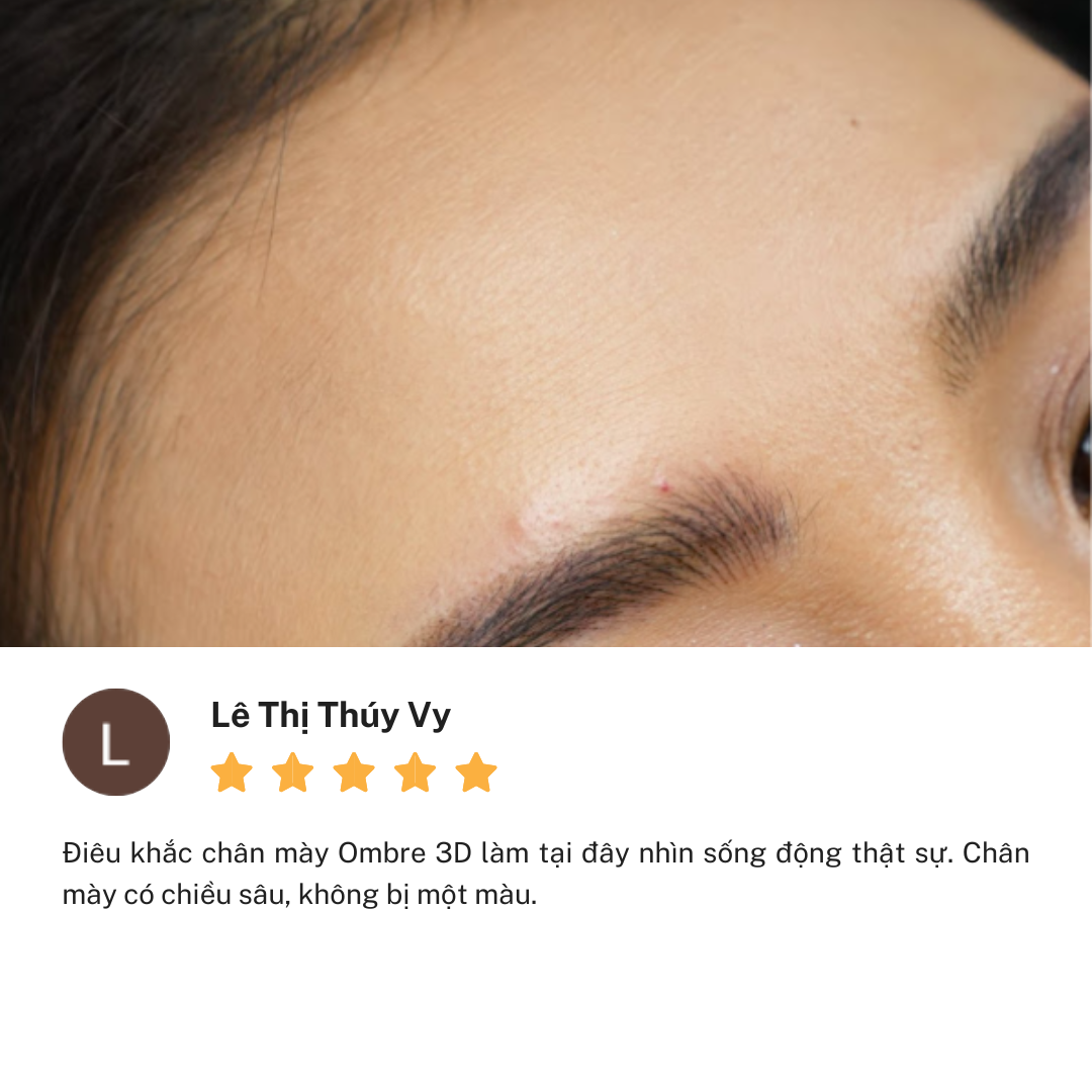 Review thẩm mỹ viện Linh Anh cơ sở Nguyễn Thị Thập