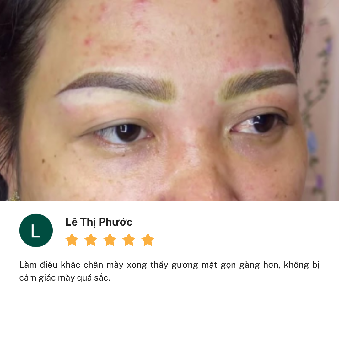 Review cơ sở Thẩm Mỹ Linh Anh Phan Văn Trị