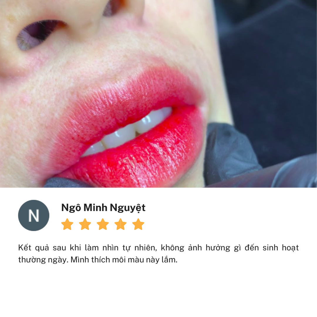 Review Thẩm Mỹ Viện Linh Anh cơ sở Võ Thị Sáu Đồng Nai