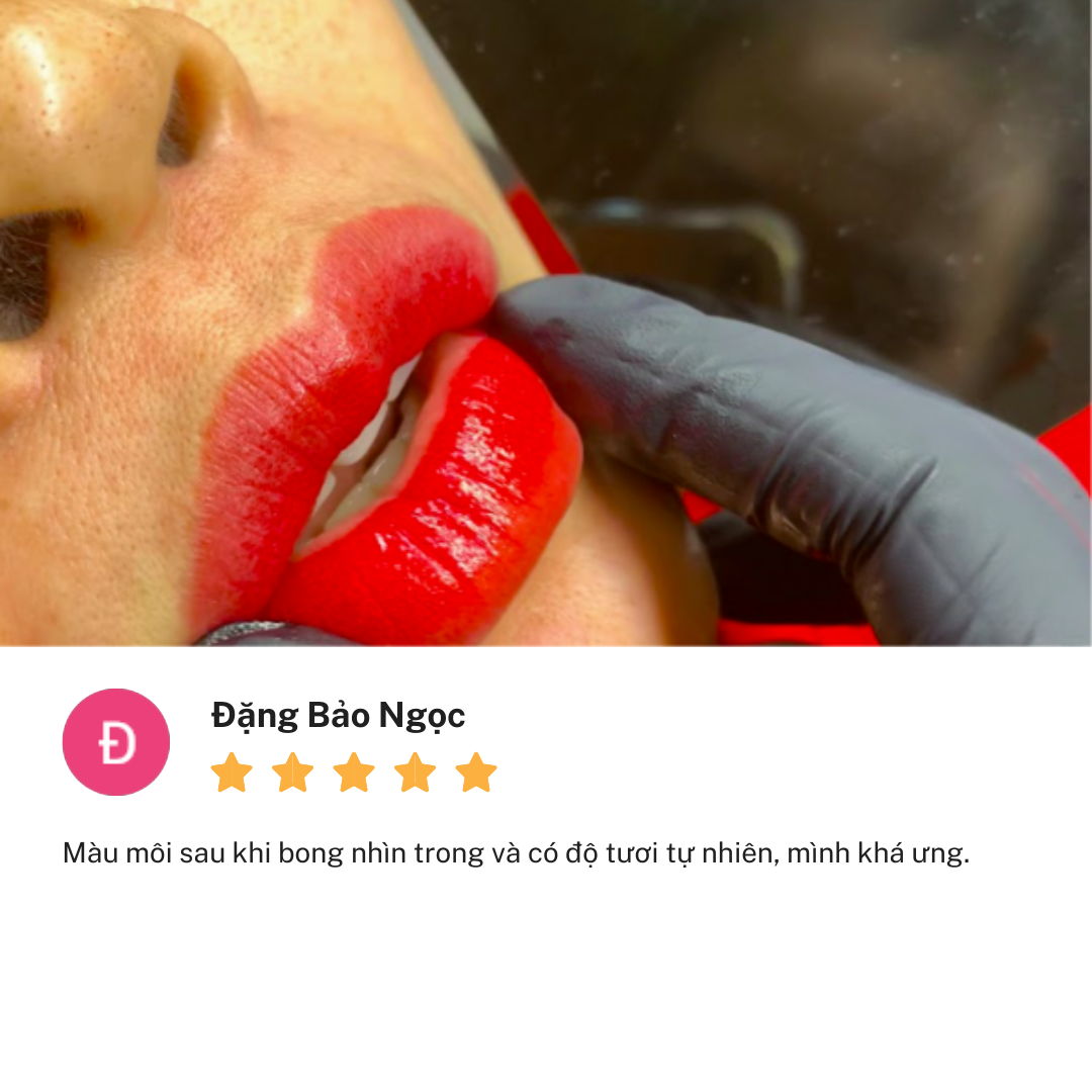 Review Thẩm Mỹ Viện Linh Anh cơ sở Võ Thị Sáu Đồng Nai