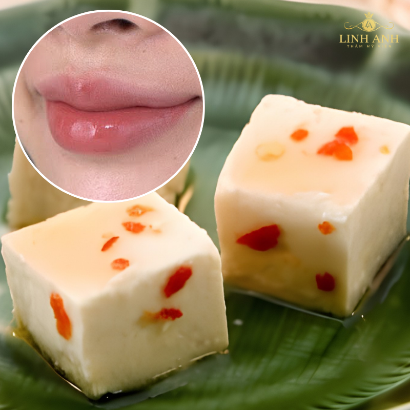 Không ăn chao sau phun môi
