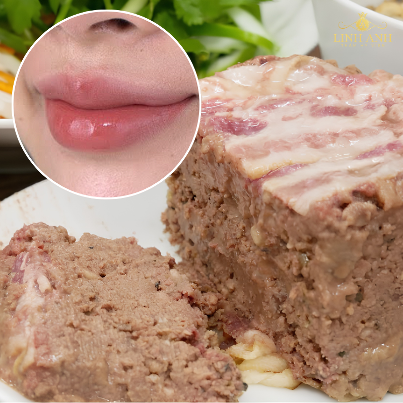 Không nên ăn pate sau phun môi
