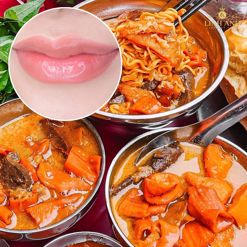 Kiêng ăn phá lấu sau phun môi