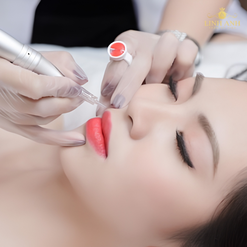 Lưu ý khi lựa chọn kim phun môi